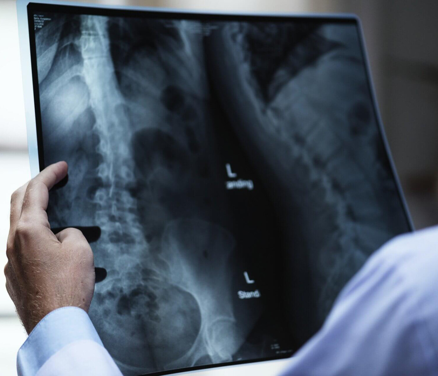 Doctor inspecting X-ray image